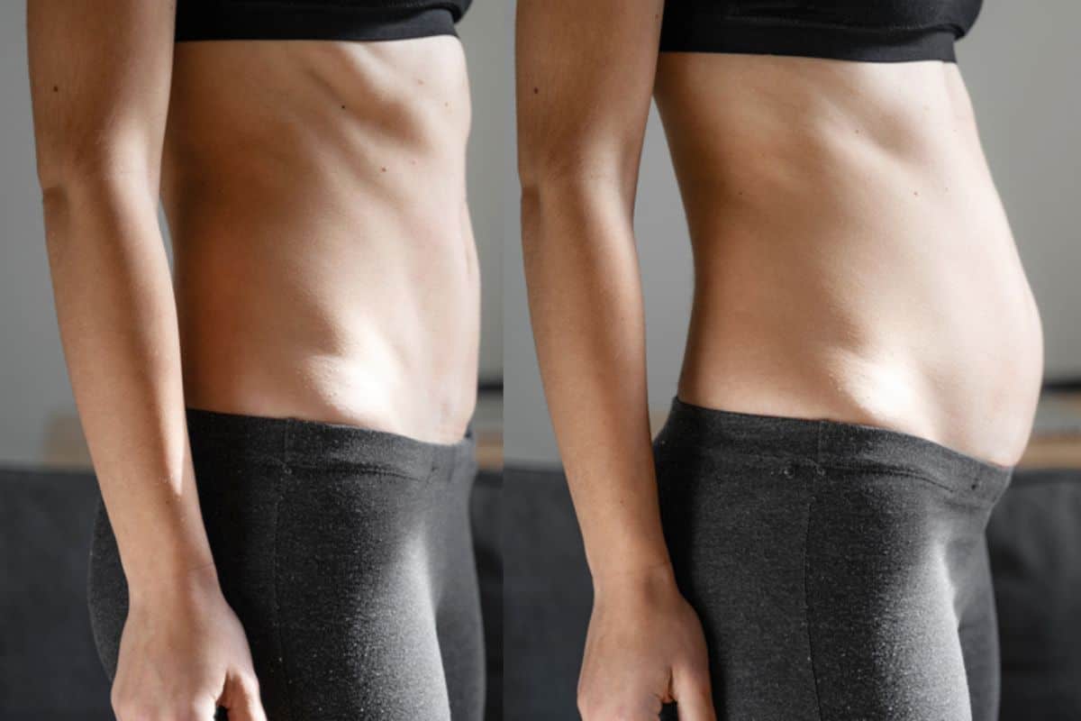 How long does diastasis recti take to improve Canary Wharf?