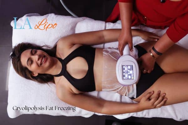 woman getting cryolipolysis Canary Wharf