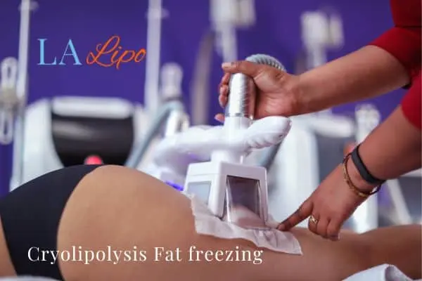 women getting fat freezing Canary Wharf