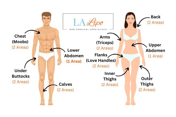 LA LIPO Cryolipolysis Areas Canary Wharf