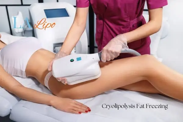 Woman receiving coolsculpting Canary Wharf treatment on her thighs
