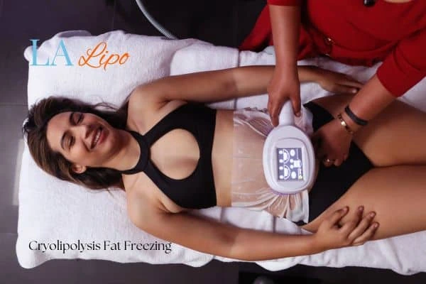 woman getting cryolipolysis Canary Wharf