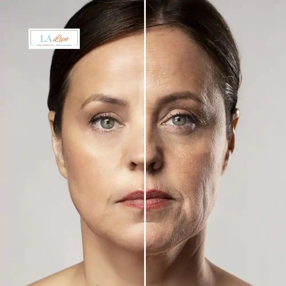 How Can You Tell If Non-Surgical Skin Tightening Is Right for You Canary Wharf?