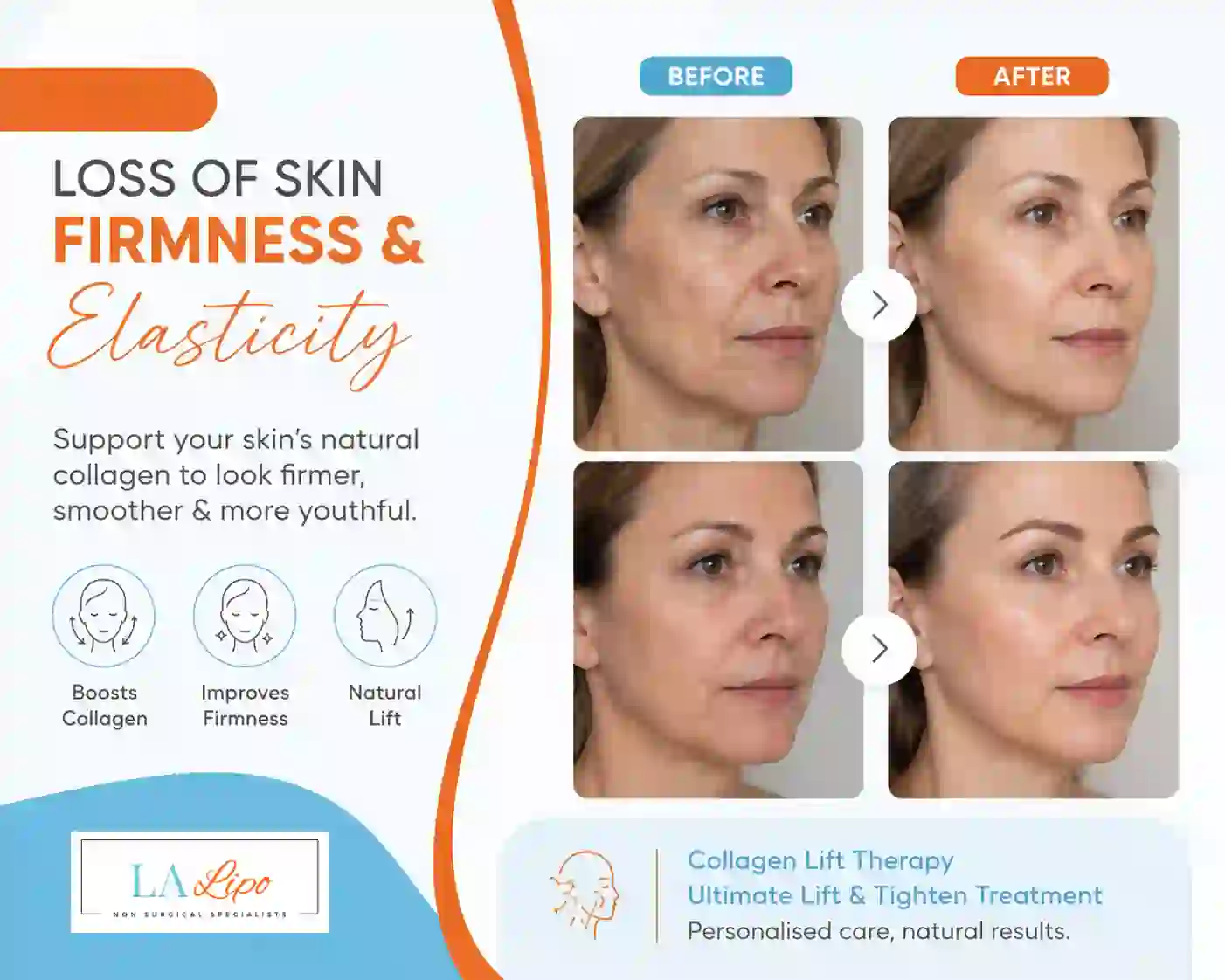 Sign #7: Loss of Skin Firmness and Elasticity Canary Wharf